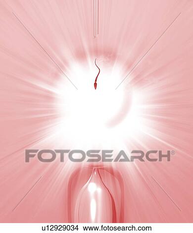 In vitro fertilisation, artwork View Large Photo Image Picture - In vitro fertilisation, artwork. Fotosearch