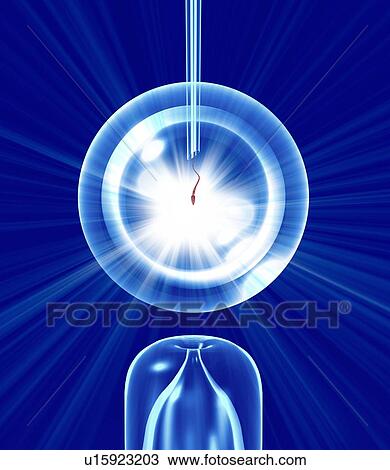 In vitro fertilisation, artwork View Large Photo Image Stock Image - In vitro fertilisation, artwork. Fotosearch