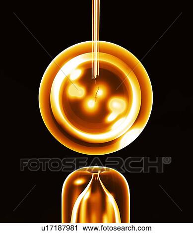 In vitro fertilisation, artwork View Large Photo Image Stock Image - In vitro fertilisation, artwork. Fotosearch