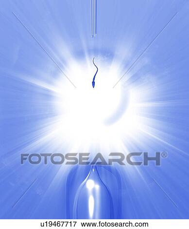 Stock Photo - In vitro fertilisation, artwork. Fotosearch