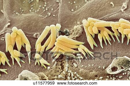 Stock Photo - Inner ear hair cells, SEM. Fotosearch