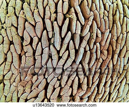 Stock Image - Intestinal lining, SEM. Fotosearch