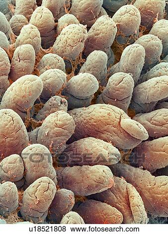 Stock Photo - Intestinal lining, SEM. Fotosearch