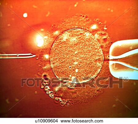 IVF treatment, light micrograph View Large Photo Image Picture - IVF treatment, light micrograph. Fotosearch