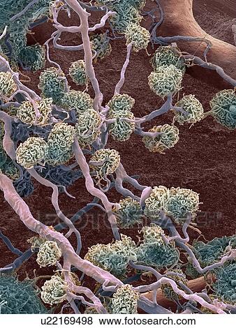 Kidney glomeruli, SEM View Large Photo Image Stock Photo - Kidney glomeruli, SEM. Fotosearch