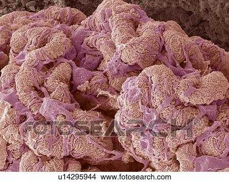 Kidney glomerulus, SEM View Large Photo Image Picture - Kidney glomerulus, SEM. Fotosearch