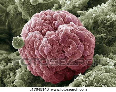 Kidney glomerulus, SEM View Large Photo Image Stock Image - Kidney glomerulus, SEM. Fotosearch