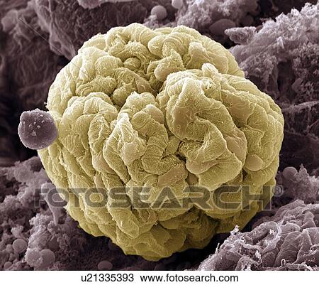 Stock Image - Kidney glomerulus, SEM. Fotosearch