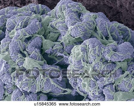 Stock Photography - Kidney glomerulus, SEM. Fotosearch