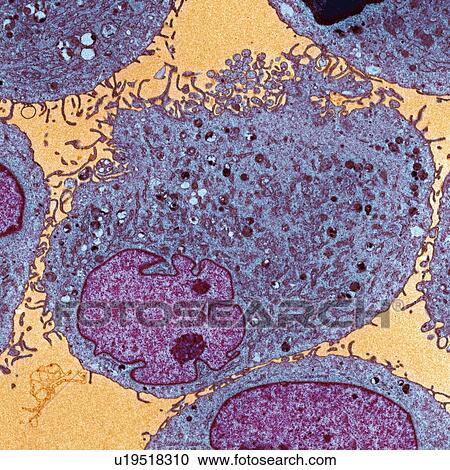 Leukaemia cells, TEM View Large Photo Image Stock Image - Leukaemia cells, TEM. Fotosearch
