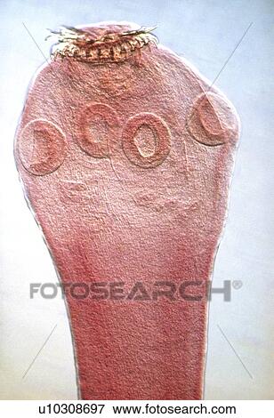 Stock Photo - LM of the head of a tapeworm, Taenia pisiformis. Fotosearch