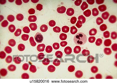 LM showing human red and white blood cells View Large Photo Image Stock Photograph - LM showing human red and white blood cells. Fotosearch