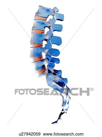 Stock Photo - Lumbar spine and sacrum, computer artwork. Fotosearch