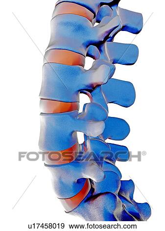 Stock Photo - Lumbar spine, computer artwork. Fotosearch