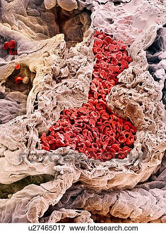 Lung blood vessel, SEM View Large Photo Image Stock Photo - Lung blood vessel, SEM. Fotosearch