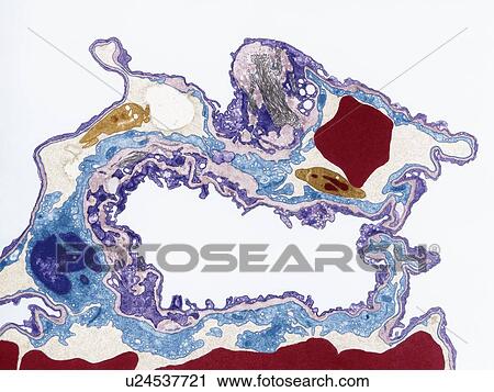 Lung tissue, TEM View Large Photo Image Stock Image - Lung tissue, TEM. Fotosearch