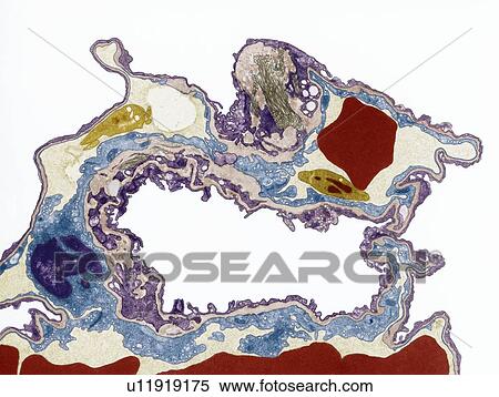 Lung tissue, TEM View Large Photo Image Stock Photography - Lung tissue, TEM. Fotosearch