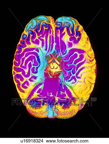 Mascagni artwork of human brain & blood vessels View Large Photo Image Picture - Mascagni artwork of human brain & blood vessels. Fotosearch