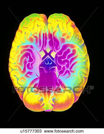 Stock Image - Mascagni artwork of human brain & blood vessels. Fotosearch