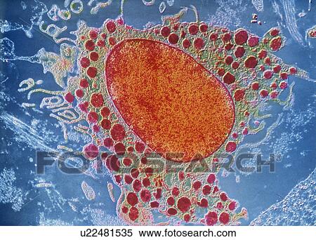 Stock Photography - Mast cell, TEM. Fotosearch