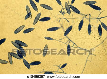 Stock Photo - Microsporum fungus. Fotosearch
