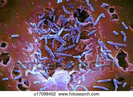 Stock Image - Mycobacterium chelonae bacteria, SEM. Fotosearch