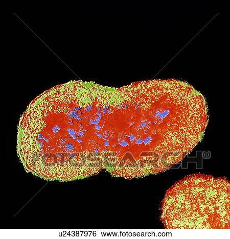 Stock Photograph - Neisseria gonorrhoeae bacterium. Fotosearch