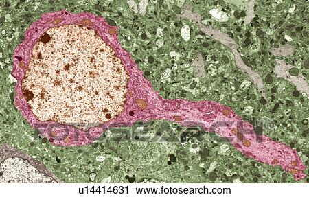 Stock Image - Nerve cell, TEM. Fotosearch