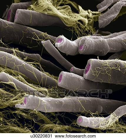 Nerve fibres, SEM View Large Photo Image Stock Image - Nerve fibres, SEM. Fotosearch