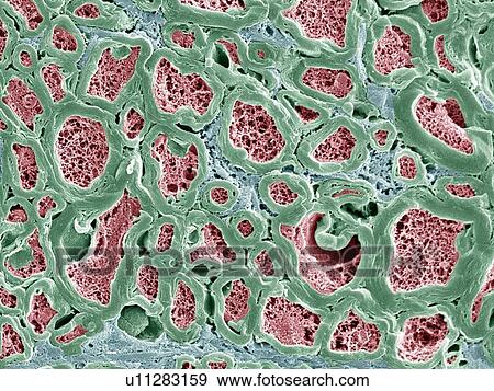 Nerve fibres, SEM View Large Photo Image Stock Photo - Nerve fibres, SEM. Fotosearch