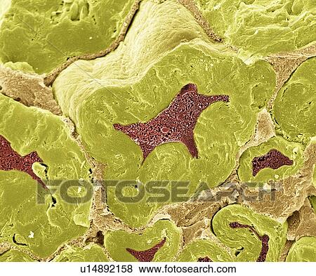 Nerve fibres, SEM View Large Photo Image Stock Photo - Nerve fibres, SEM. Fotosearch