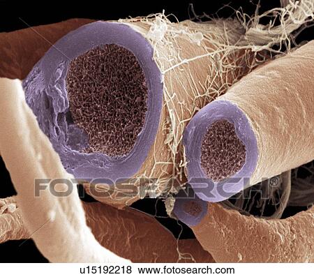 Nerve fibres, SEM View Large Photo Image Stock Photo - Nerve fibres, SEM. Fotosearch