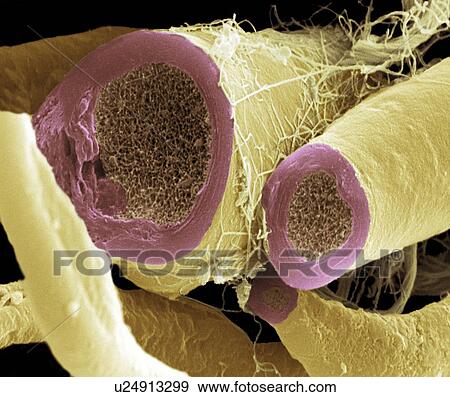 Nerve fibres, SEM View Large Photo Image Stock Photo - Nerve fibres, SEM. Fotosearch