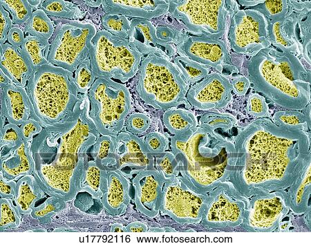 Nerve fibres, SEM View Large Photo Image Stock Photograph - Nerve fibres, SEM. Fotosearch