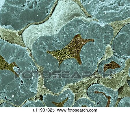 Stock Photography - Nerve fibres, SEM. Fotosearch