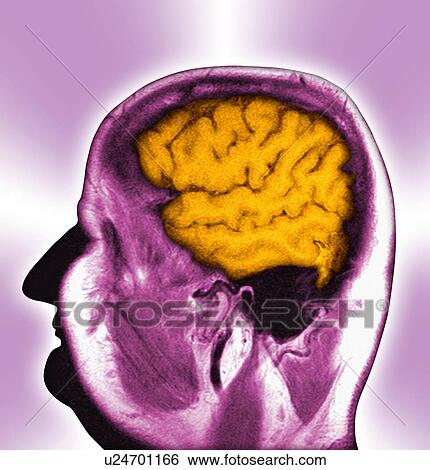 Normal brain, MRI scan View Large Photo Image Stock Photograph - Normal brain, MRI scan. Fotosearch