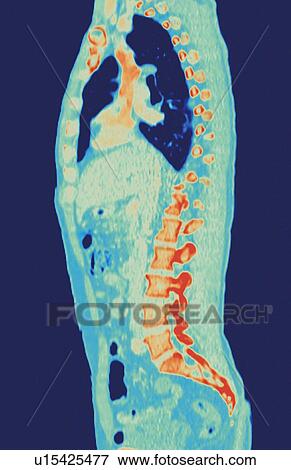 Stock Photo - Normal torso, MRI scan. Fotosearch