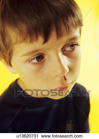 Stock Image - Nosebleed. Fotosearch