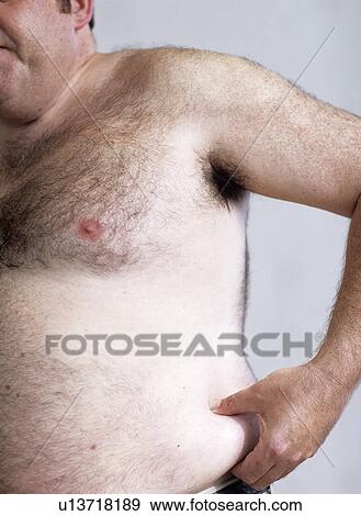 Stock Photo - Obesity. Fotosearch