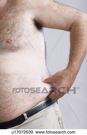 Stock Photo - Obesity. Fotosearch