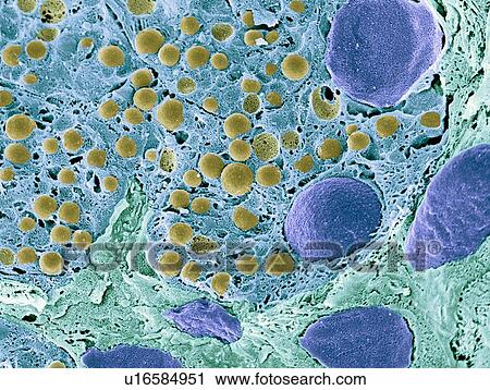 Stock Image - Pancreas tissue, SEM. Fotosearch