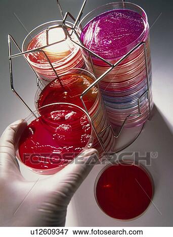 Stock Photo - Petri dish bacterial culture being placed in stack. Fotosearch