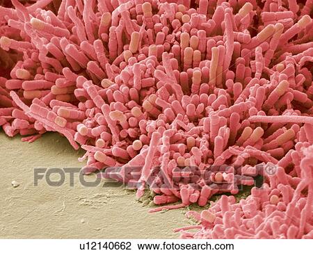 Stock Image - Plaque-forming bacteria, SEM. Fotosearch