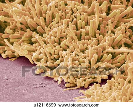 Plaque-forming bacteria, SEM View Large Photo Image Stock Photo - Plaque-forming bacteria, SEM. Fotosearch