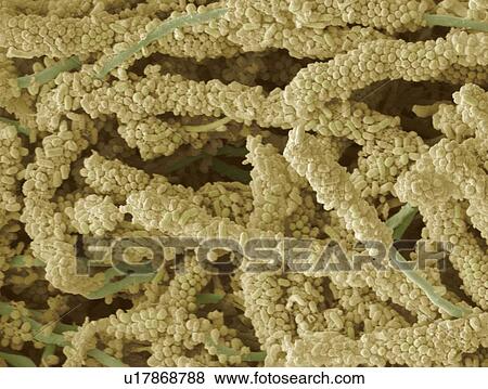 Plaque-forming bacteria, SEM View Large Photo Image Stock Photo - Plaque-forming bacteria, SEM. Fotosearch