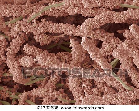 Plaque-forming bacteria, SEM View Large Photo Image Stock Photo - Plaque-forming bacteria, SEM. Fotosearch