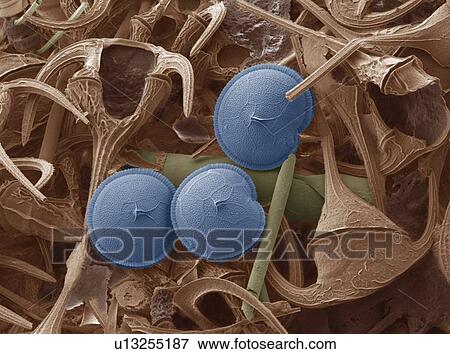 Prorocentrum dinoflagellates, SEM View Large Photo Image Stock Photo - Prorocentrum dinoflagellates, SEM. Fotosearch