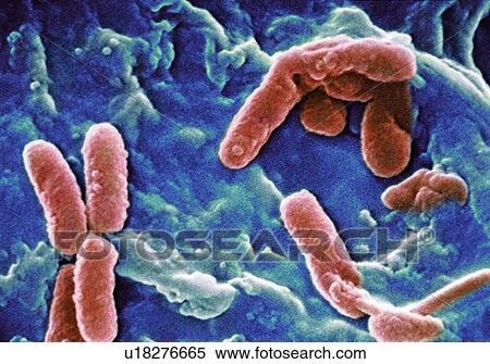 Pseudomonas aeruginosa bacteria, SEM View Large Photo Image Stock Photography - Pseudomonas aeruginosa bacteria, SEM. Fotosearch
