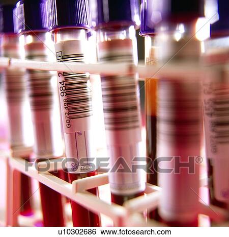 Rack of sample tubes containing blood for analysis View Large Photo Image Stock Photograph - Rack of sample tubes containing blood for analysis. Fotosearch