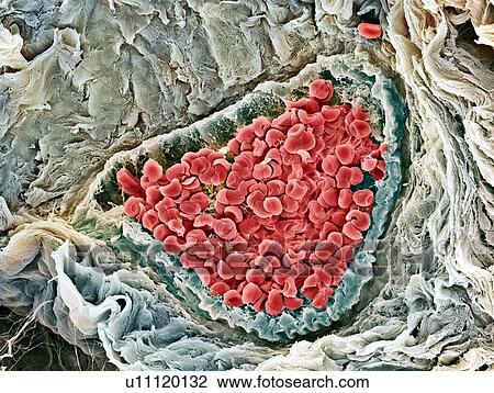 Red blood cells, SEM View Large Photo Image Stock Image - Red blood cells, SEM. Fotosearch